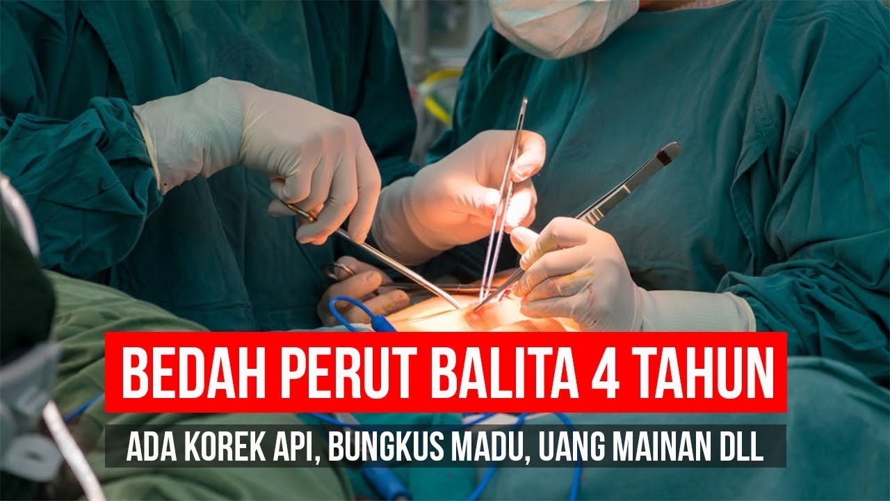 Arti Mimpi Operasi Perut: Pertanda Baik atau Buruk? Ketahui Tafsirnya Disini!